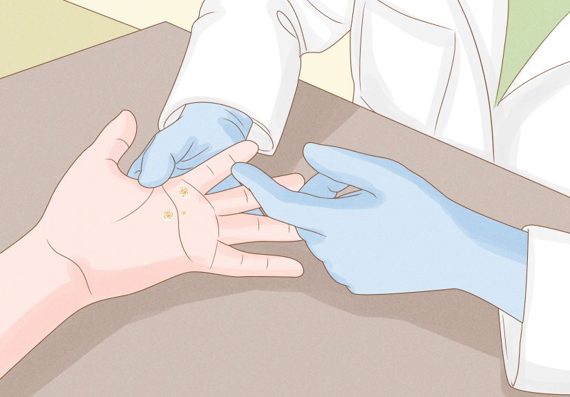 3 Ways to Treat a Wart at Home