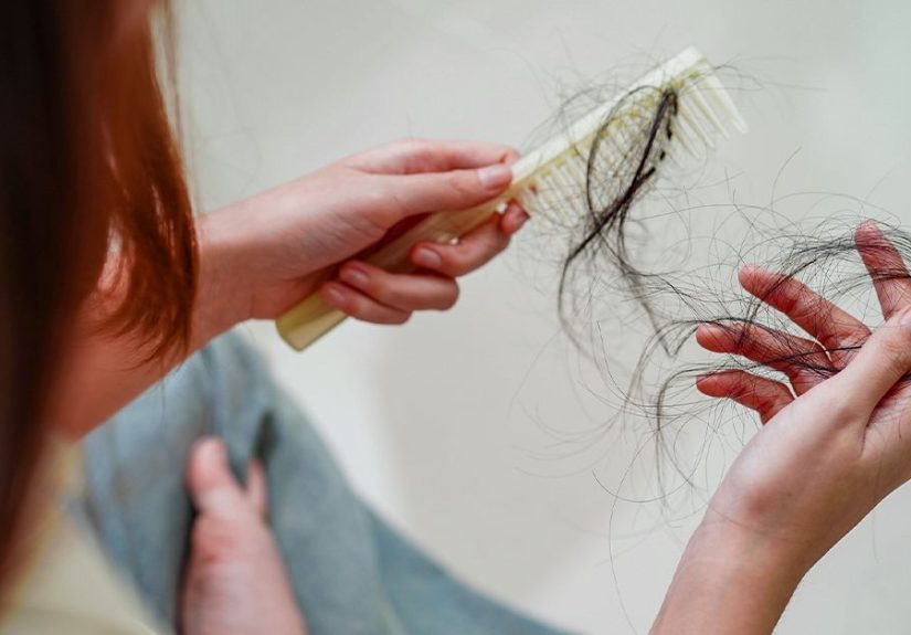 Hair Loss from Lyme Disease: What’s the Connection?