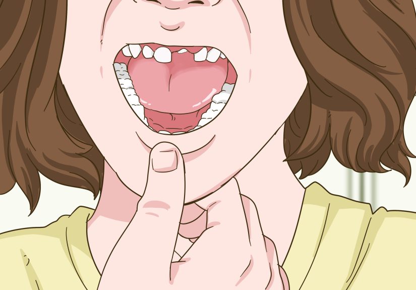 How to Painlessly Pull Out a Loose Baby Tooth At Home