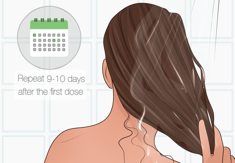 How to Remove Lice Using Tea Tree Oil: Natural Treatment