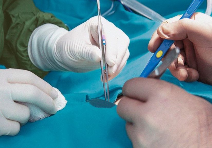 Ileostomy vs. colostomy: Definition, purpose, and procedure