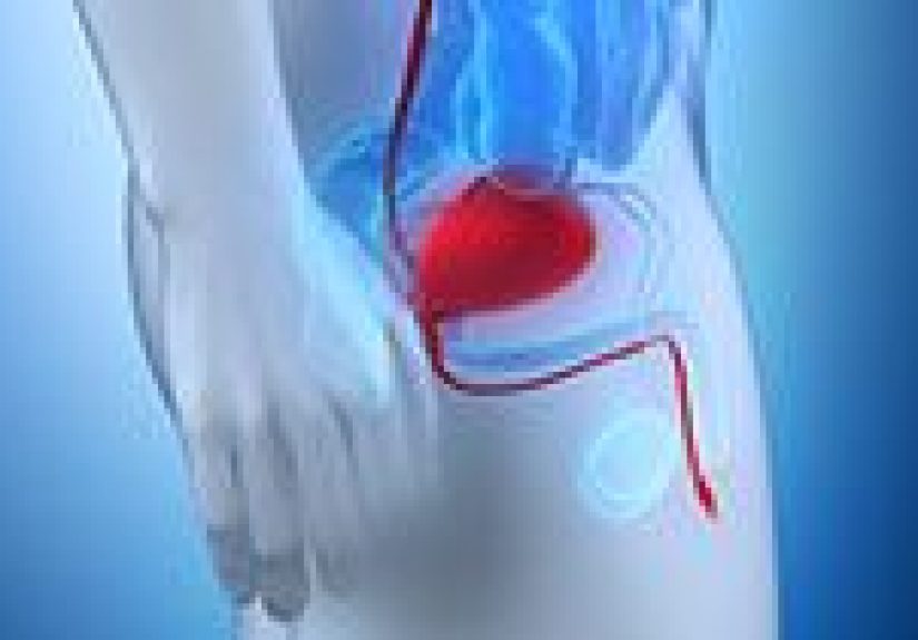 What Are Your Treatment Options for an Enlarged Prostate?