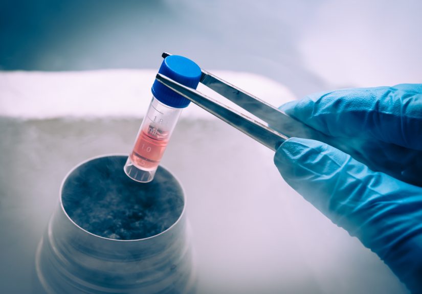 What to Consider Before Undergoing Stem Cell Treatment or Banking Stem Cells