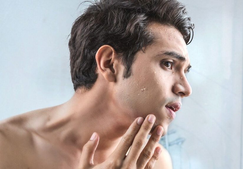 Cold Sore vs. Pimple: Symptoms and Treatment