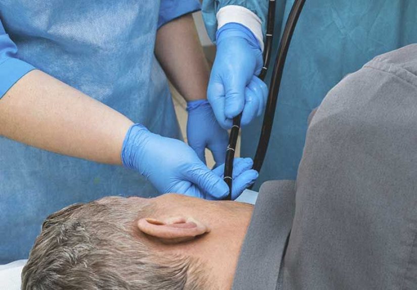 Esophageal Thrush: Risks, Symptoms, and Treatment