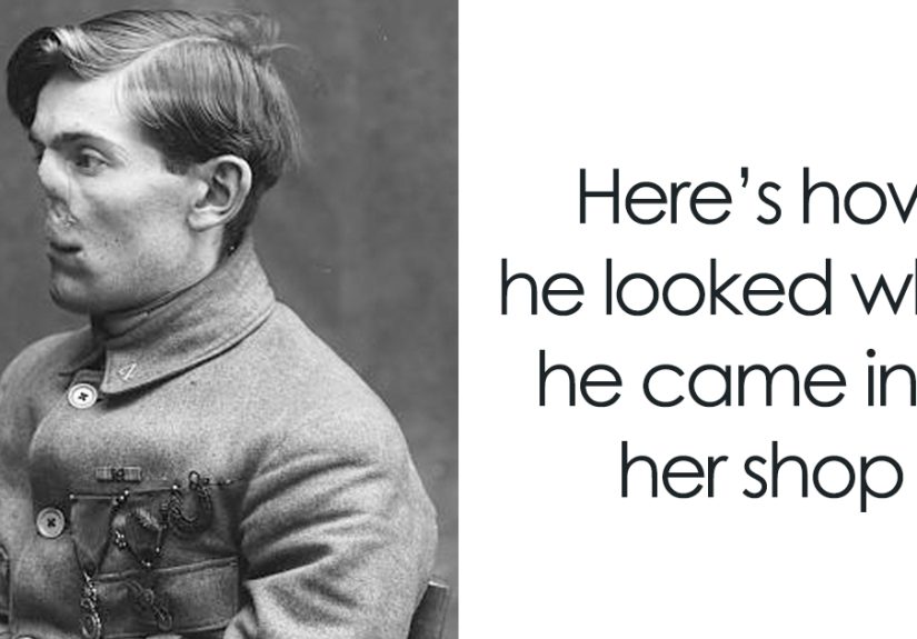 Fascinating Before & After Pics Show How This Woman Changed Lives Of WWI Veterans By ‘Restoring’ Their Faces