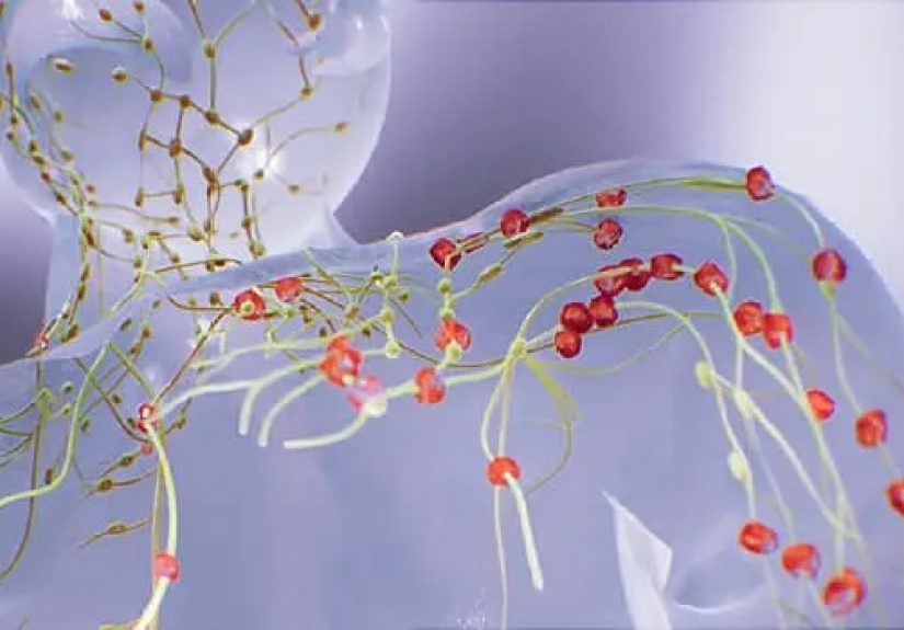 Gene Therapy That Treats Diffuse Large B-Cell Lymphoma
