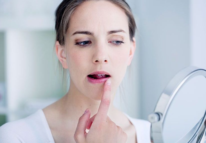 How to get rid of a pimple on lip: Treatments and remedies