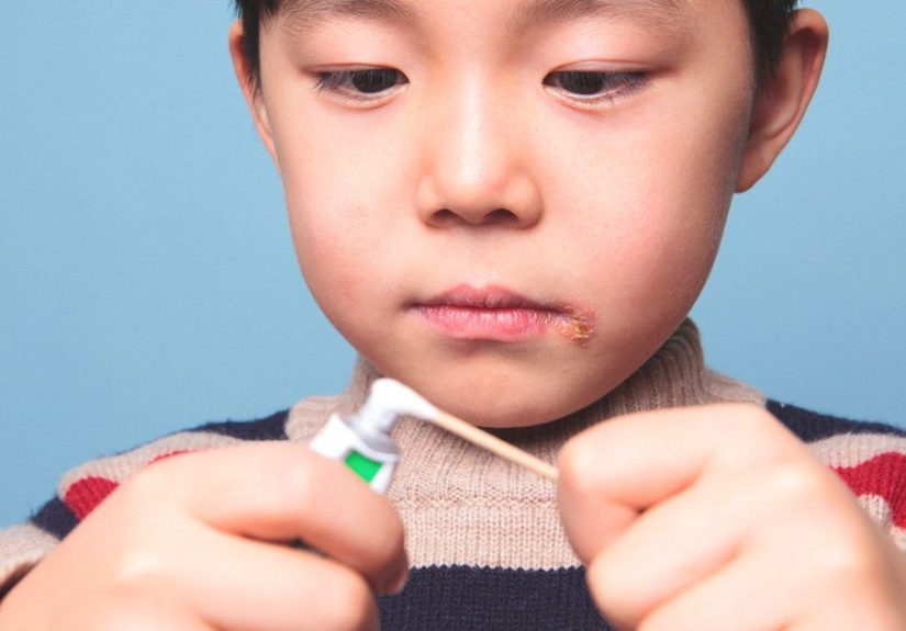 Lysine for Cold Sores: Treatment, Risks, and More