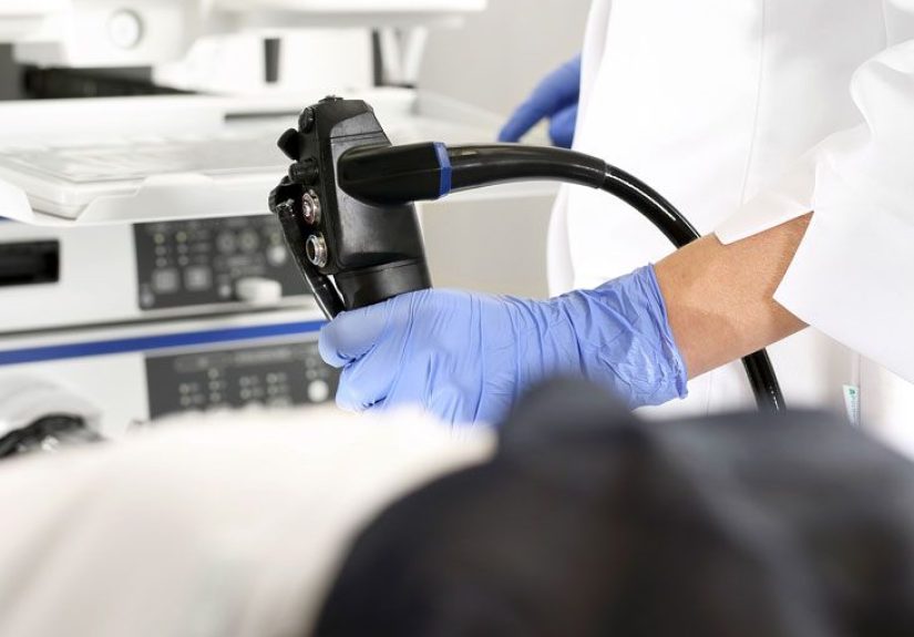 Sigmoidoscopy: Purpose, Procedure, and Results
