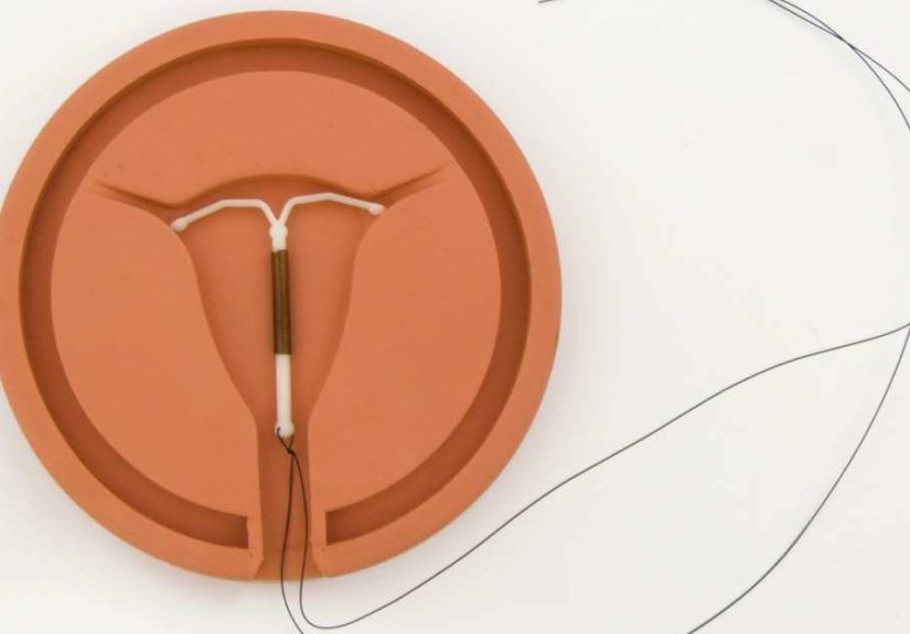 Which IUDs Are the Best? Benefits, Risks, and Side Effects
