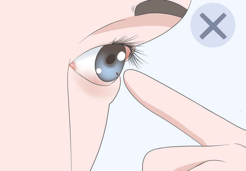 3 Ways to Get Sand Out of Your Eyes