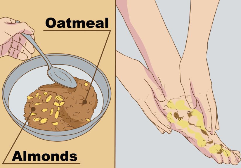 3 Ways to Remove Dead Skin from Feet