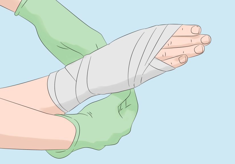 3 Ways to Survive a Shark Attack