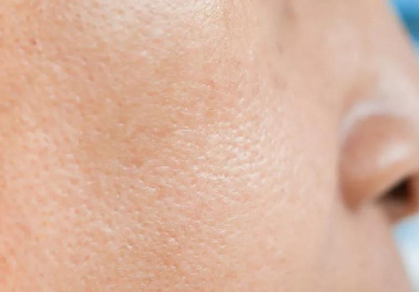 7 Dermatologist Approved Tips to Shrink Your Pores