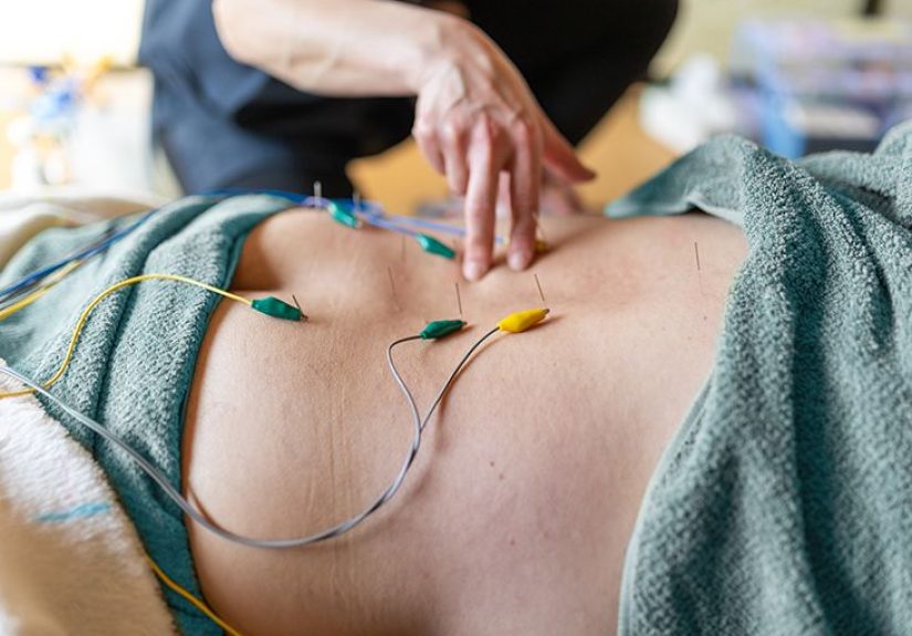 Acupuncture for Overactive Bladder: Pros, Cons, and More