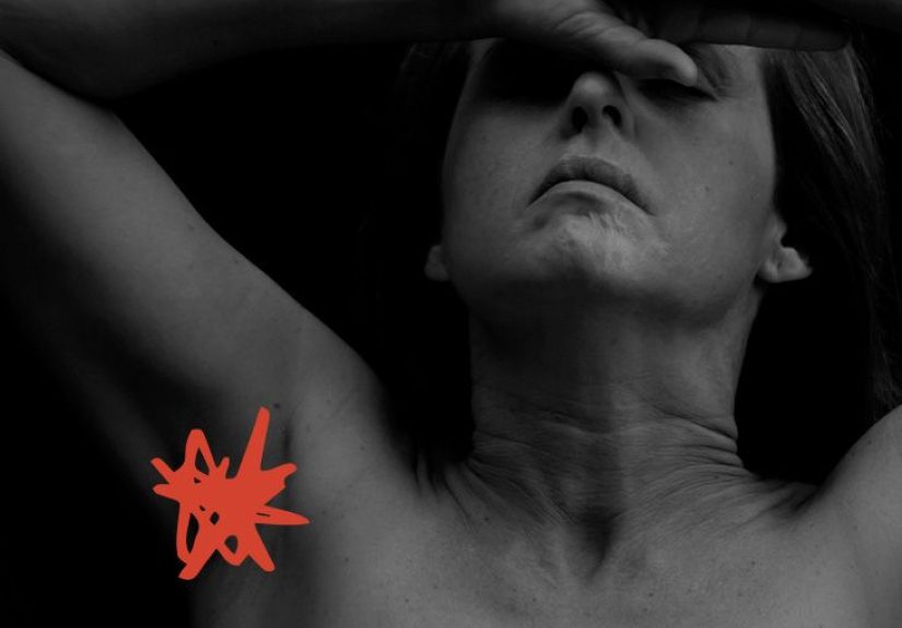 Armpit rash: Causes, treatment, and prevention