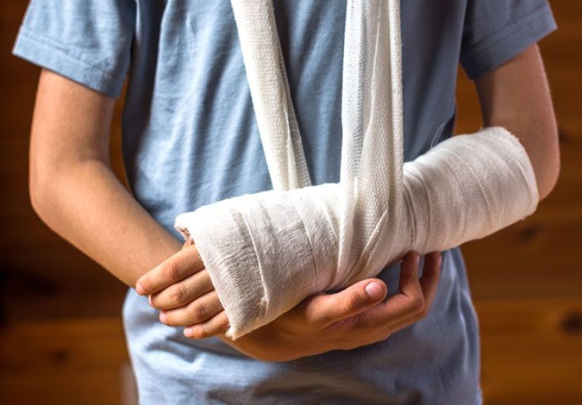 Bone Graft: Purpose, Procedure, and Risks