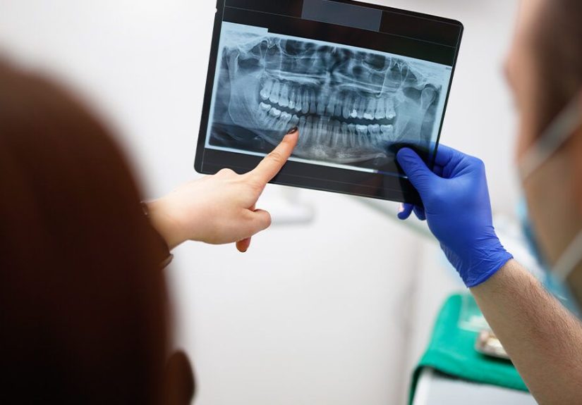 Can You Reverse a Cavity? How to Stop and Prevent Tooth Decay