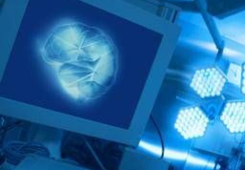 Decompressive craniectomy: All you need to know