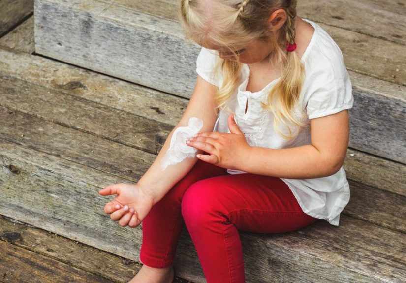 Eczema (Atopic Dermatitis): Symptoms, Causes, Treatment
