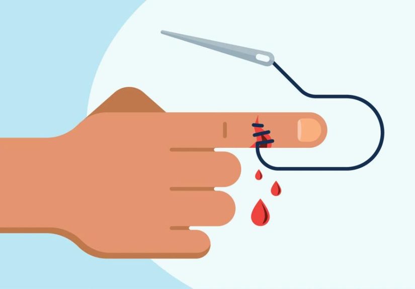 How Do You Know if You Need Stitches?
