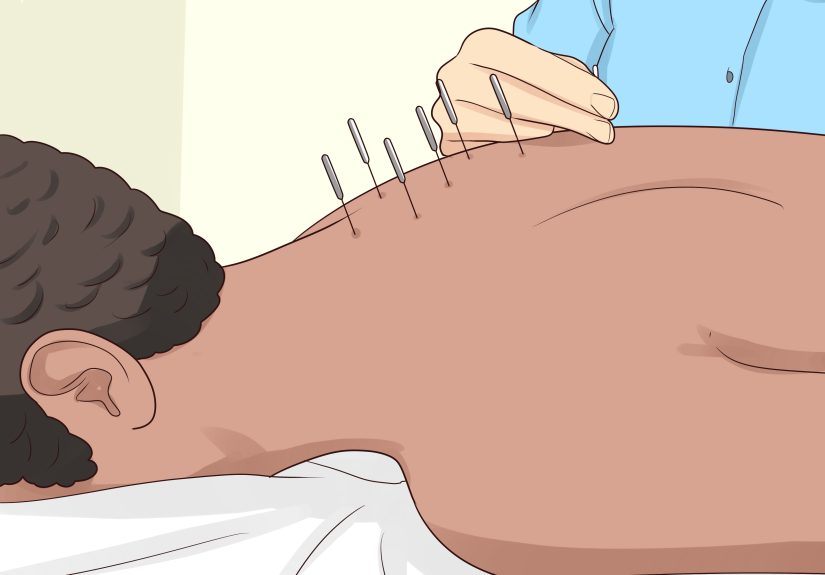 How to Sleep with Neck Pain: 15 Steps