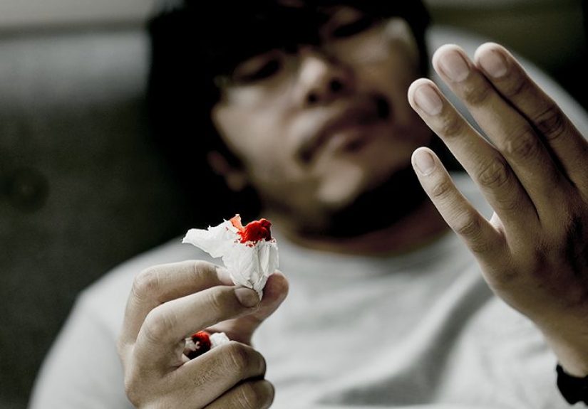 How to Stop a Nosebleed: Tips and Treatment