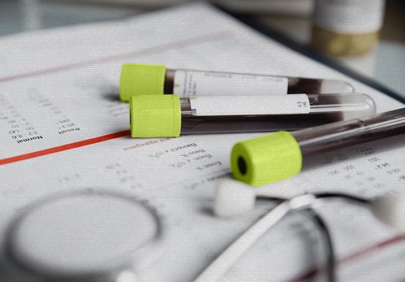 Lymphoplasmacytic lymphoma: Treatment, outlook, and more