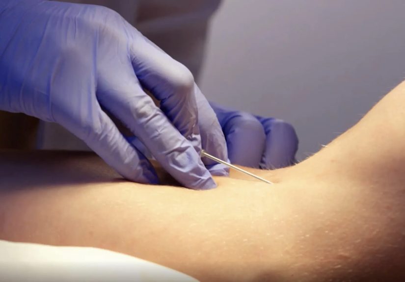 Video on How You Take Biologic Drugs for RA