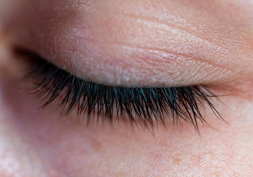Why Do My Eyelashes Hurt? Potential Causes, Treatment, Prevention
