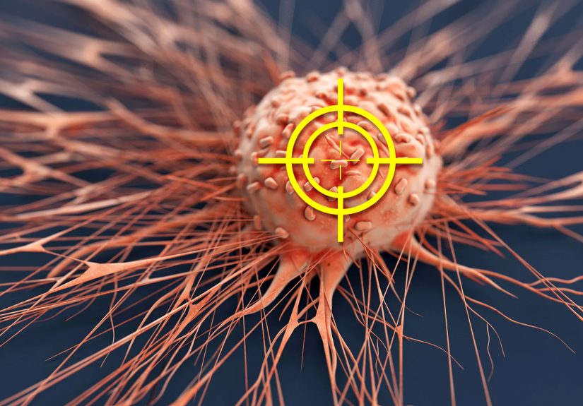 Your Chronic Lymphocytic Leukemia Treatment Options