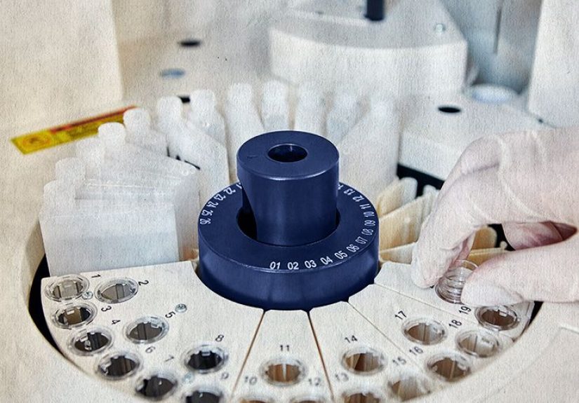 Alkaline Phosphatase (ALP) Level Test: High and Low Levels