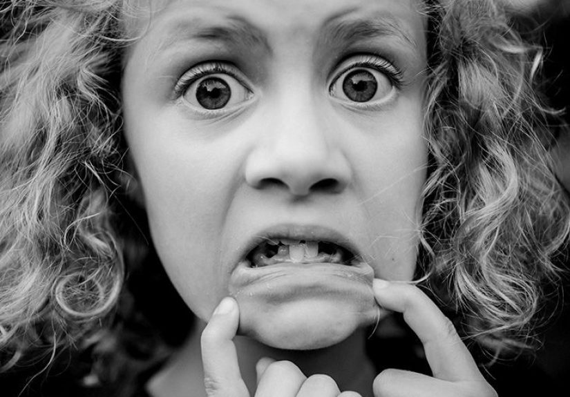 Depressor anguli oris: What it is, botox, exercises, and more