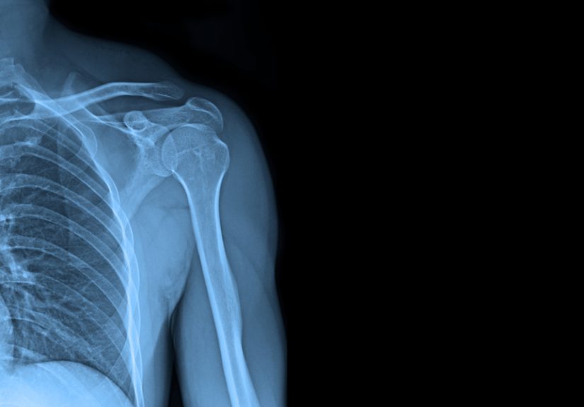 Dislocations: an Exception to the Rule