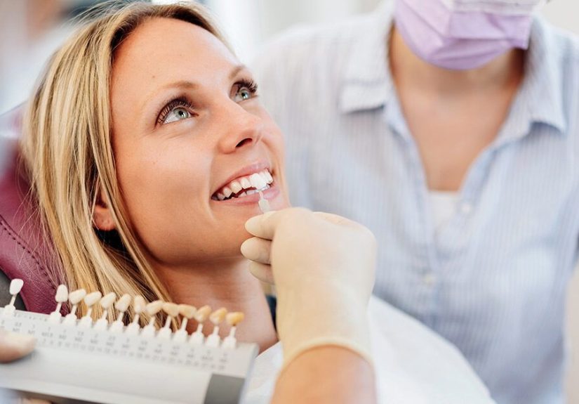 How Long Do Veneers Last? Porcelain and Composite Veneers