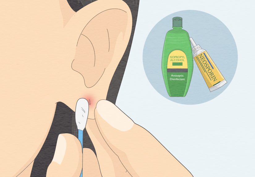 How to Clean Your Ear Piercing Properly to Prevent Infections