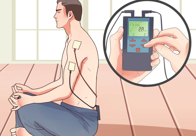 How to Place Electrodes for a TENS Unit: 11 Steps