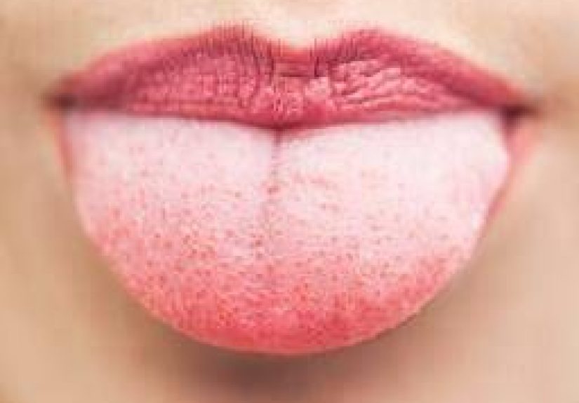 How Your Taste Buds Could Help Tackle Obesity