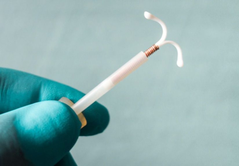 Is IUD Insertion Painful? Expert Answers You Need to Know