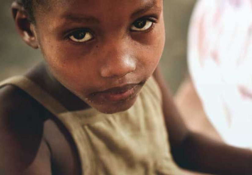 Kwashiorkor and Marasmus: What's the Difference?