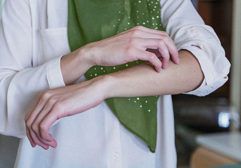 Polycythemia vera skin: What does it look like?