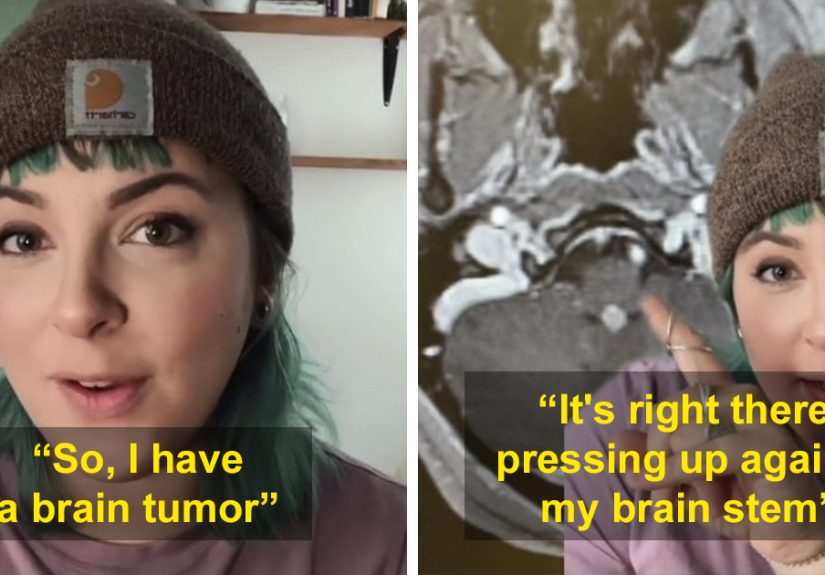Woman With Brain Tumor Scared And Heartbroken Over The Fact She Can’t Get It Removed Because Of Unvaccinated People